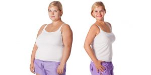 Lire la suite de l'article Chirurgie de l'obésité: comment se préparer à perdre beaucoup de poids